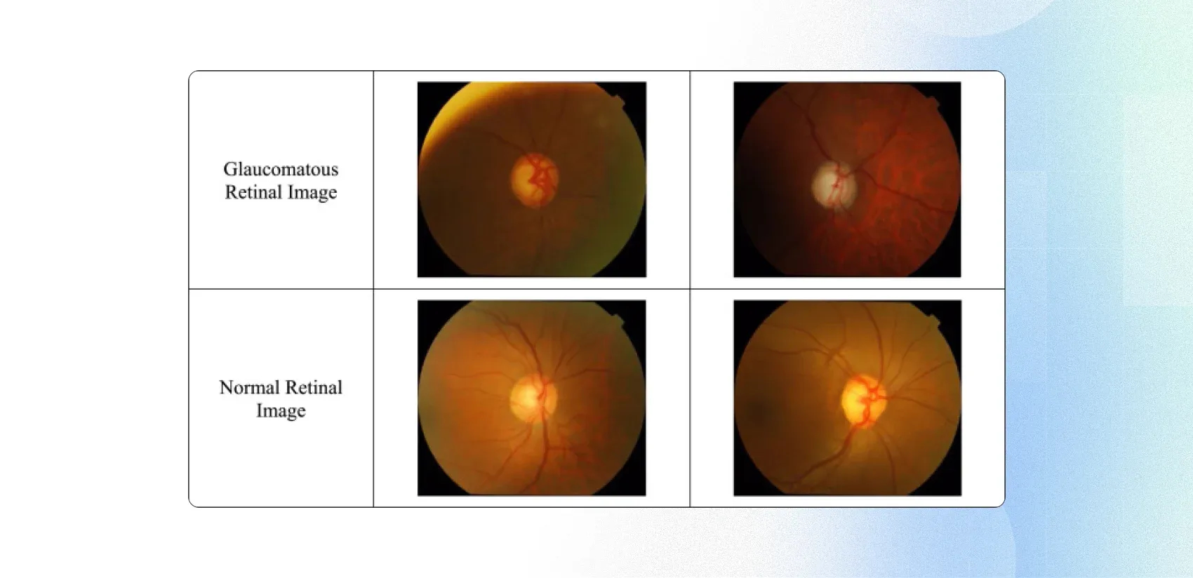 use of image classification in healthcare